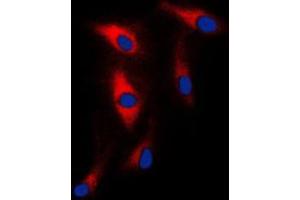 Immunofluorescent analysis of MAST2 staining in HeLa cells. (MAST2 antibody  (Center))