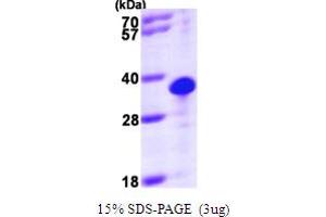 SDS-PAGE (SDS) image for Thiamine Triphosphatase (THTPA) (AA 1-230) protein (His tag) (ABIN667184) (THTPA Protein (AA 1-230) (His tag))