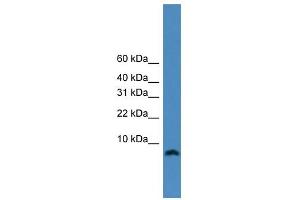 WB Suggested Anti-KIAA0101 Antibody Titration:  0. (KIAA0101 antibody  (N-Term))