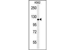 Western blot analysis of POTEE Antibody (Center) in K562 cell line lysates (35ug/lane). (POTEE antibody  (Middle Region))