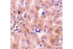 Immunohistochemistry of Bfl-1 in mouse kidney tissue with Bfl-1 antibody at 10 μg/ml. (BCL2A1 antibody  (C-Term))
