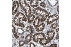 Immunohistochemical staining of human kidney with KIAA1958 polyclonal antibody  shows strong cytoplasmic positivity tubular cells. (KIAA1958 antibody)