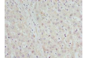 Immunohistochemistry of paraffin-embedded human liver tissue using ABIN7142066 at dilution of 1:100 (GBE1 antibody  (AA 1-300))