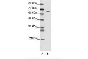 Image no. 1 for anti-Zinc Finger Protein 205 (ZNF205) (AA 31-80) antibody (ABIN202754)