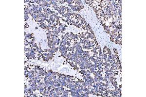 IHC analysis of SUMF2 using anti-SUMF2 antibody (ABIN7600954). (SUMF2 antibody  (AA 26-301))