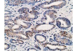 Immunohistochemistry (IHC) image for anti-Aldehyde Dehydrogenase 1 Family, Member A3 (ALDH1A3) (AA 1-100), (AA 413-512) antibody (ABIN2715885) (ALDH1A3 antibody  (AA 1-100, AA 413-512))