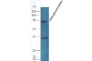 Mouse intestine lysate probed  at 1:5000 90min in 37˚C (Glucuronidase beta antibody  (AA 589-651))
