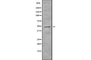 Western blot analysis of MAGAB using HepG2 whole cell lysates (MAGEA11 antibody  (C-Term))