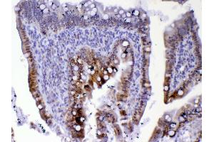 IHC analysis of Cdc20 using anti-Cdc20 antibody . (CDC20 antibody)