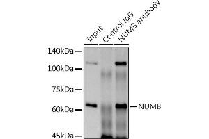Immunoprecipitation analysis of 300 μg extracts of HeLa cells using 3 μg NUMB antibody (ABIN7269073). (NUMB antibody)