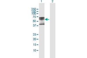 Western Blot analysis of PLA2G3 expression in transfected 293T cell line by PLA2G3 MaxPab polyclonal antibody.