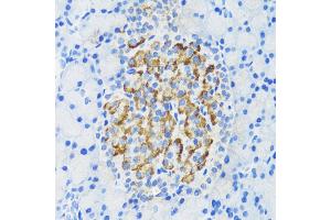 Immunohistochemistry of paraffin-embedded rat pancreatic islet using DLK1 antibody (ABIN3016512, ABIN3016513, ABIN3016514 and ABIN6219768) at dilution of 1:200 (40x lens). (DLK1 antibody)