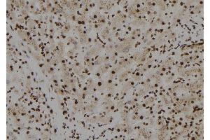 ABIN6272558 at 1/100 staining Human liver tissue by IHC-P. (TFCP2L1 antibody  (N-Term))