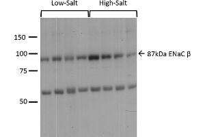 Western blot analysis of Mouse kidney cortex showing detection of ENaC protein using Rabbit Anti-ENaC Polyclonal Antibody (ABIN863203). (SCNN1A antibody  (AA 617-638))