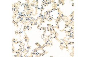 Immunohistochemistry of paraffin embedded rat lung using MAL2 (ABIN7074549) at dilution of 1: 300 (400x lens)