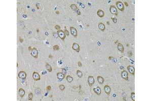 Immunohistochemistry of paraffin-embedded Rat brain using PDE1B Polyclonal Antibody at dilution of 1:100 (40x lens). (PDE1B antibody)