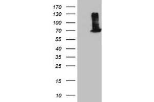 HEK293T cells were transfected with the pCMV6-ENTRY control (Left lane) or pCMV6-ENTRY EPM2AIP1 (Right lane) cDNA for 48 hrs and lysed. (EPM2AIP1 antibody)