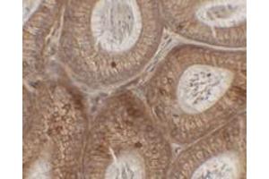 Immunohistochemical analysis of SPINK2 in mouse testis tissue with SPINK2 polyclonal antibody  at 2.