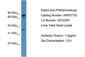 WB Suggested Anti-PDE8A  Antibody Titration: 0. (PDE8A antibody  (C-Term))