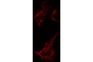 ABIN6274386 staining Hela cells by IF/ICC. (AAK1 antibody  (Internal Region))