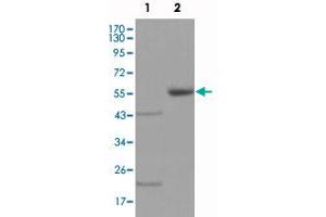 Western blot analysis using EPHA5 monoclonal antibody, clone 8B10B1  against truncated EPHA5-His recombinant protein (1) and truncated EPHA5 (aa 620-774) -hIgGFc transfected CHO-K1 cell lysate (2) . (EPH Receptor A5 antibody)