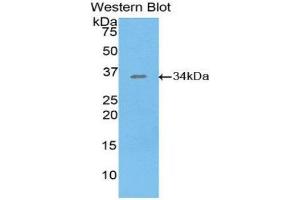 Western Blotting (WB) image for anti-Salt-Inducible Kinase 2 (SIK2) (AA 655-925) antibody (ABIN1860558) (SIK2 antibody  (AA 655-925))