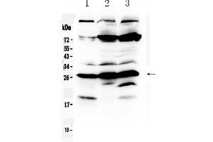 Western blot analysis of RanBP1 using anti- RanBP1 antibody .