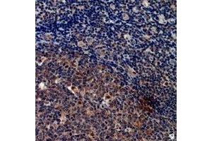 Immunohistochemical analysis of Cystatin A staining in human tonsil formalin fixed paraffin embedded tissue section. (CSTA antibody  (C-Term))