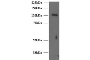 Western Blotting (WB) image for anti-Unc-13 Homolog D (UNC13D) (C-Term) antibody (ABIN2466418) (UNC13D antibody  (C-Term))