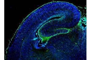 IHC-Fr Image GFAP antibody detects GFAP protein on embryonic mouse brain by immunohistochemical analysis. (GFAP antibody)
