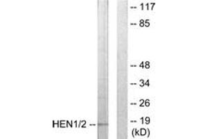 Western blot analysis of extracts from Jurkat cells, using HEN1/2 Antibody. (HEN1/2 (AA 41-90) antibody)