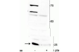 Western blot of mouse heart lysate showing specific immunolabeling of ~25 kDa cardiac troponin I protein phosphorylated at Ser150 in the first lane (-). (TNNI3 antibody  (pSer150))