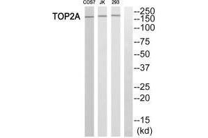 Western blot analysis of extracts from HT-29 cells, using TOP2A antibody. (Topoisomerase II alpha antibody  (N-Term))