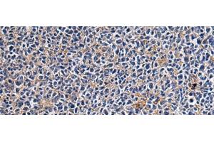 Immunohistochemistry of paraffin-embedded Human tonsil tissue using CEP89 Polyclonal Antibody at dilution of 1:95(x200) (CEP89 antibody)