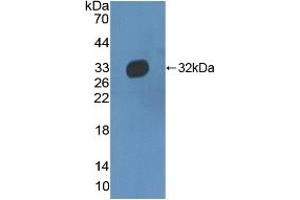 Western blot analysis of recombinant Human HPR. (HPR antibody  (AA 102-347))