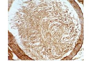 Mouse testis tissue was stained by Rabbit Anti-Desnutrin (465-486) (Mouse) Serum (PNPLA2 antibody  (AA 465-486))