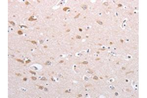 The image on the left is immunohistochemistry of paraffin-embedded Human brain tissue using ABIN7130592(PFN4 Antibody) at dilution 1/20, on the right is treated with fusion protein. (Profilin 4 antibody)