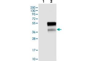 Western blot analysis of Lane 1: Negative control (vector only transfected HEK293T lysate). (C22ORF29 antibody)