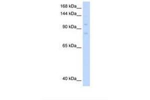 Image no. 2 for anti-Minichromosome Maintenance Deficient 8 (MCM8) (AA 717-766) antibody (ABIN6737804)