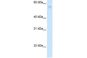GLUT2 antibody used at 1 ug/ml to detect target protein. (SLC2A2 antibody)
