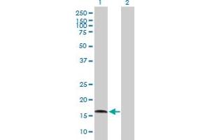 Western Blot analysis of AGTRAP expression in transfected 293T cell line by AGTRAP MaxPab polyclonal antibody. (AGTRAP antibody  (AA 1-152))