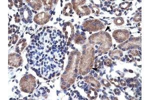 Human kidney (Bcl-2 antibody  (N-Term))