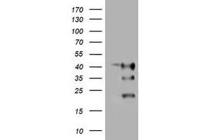 Image no. 1 for anti-Transmembrane Protein 173 (TMEM173) antibody (ABIN1501423) (STING/TMEM173 antibody)