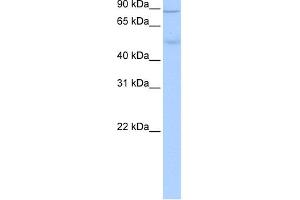 WB Suggested Anti-ALDH1L1 Antibody Titration: 0. (ALDH1L1 antibody  (Middle Region))