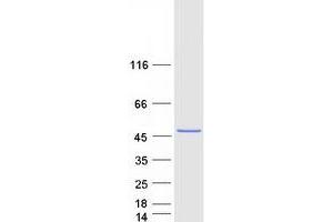 Snurportin 1 (SNUPN) (Transcript Variant 1) protein (Myc-DYKDDDDK Tag)