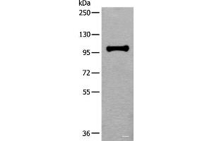 Western blot analysis of HEPG2 cell lysate using HELLS Polyclonal Antibody at dilution of 1:400