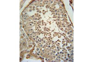 ADCY Antibody (C-term) (ABIN651855 and ABIN2840424) immunohistochemistry analysis in formalin fixed and paraffin embedded human testis tissue followed by peroxidase conjugation of the secondary antibody and DAB staining. (PACAP antibody  (C-Term))