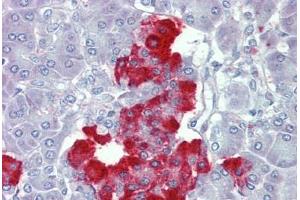 Pancreas, Human: Formalin-Fixed, Paraffin-Embedded (FFPE) (PDGF-BB Homodimer (AA 222-233) antibody)