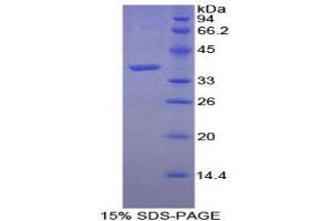SDS-PAGE (SDS) image for Calcineurin (CAN) (AA 7-301) protein (His tag) (ABIN1879700)