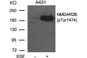 Western blot analysis of extracts from A431 cells untreated or treated with EGF using NMDAR2B (phospho-Tyr1474) Antibody. (GRIN2B antibody  (pTyr1474))